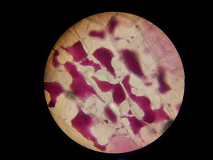 uploads/3203/30-zwiebel_plasmolyse_400x.jpg