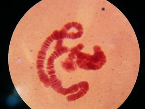 uploads/3203/32-riesenchromosomen_1000x_-2.jpg