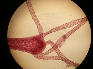 uploads/3203/sueswasserpolyp_100x_.1.jpg